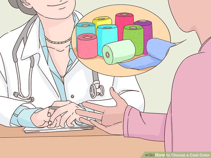 How to Choose a Cast Color