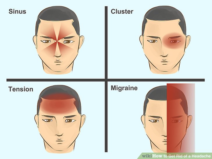 How to Get Rid of a Headache